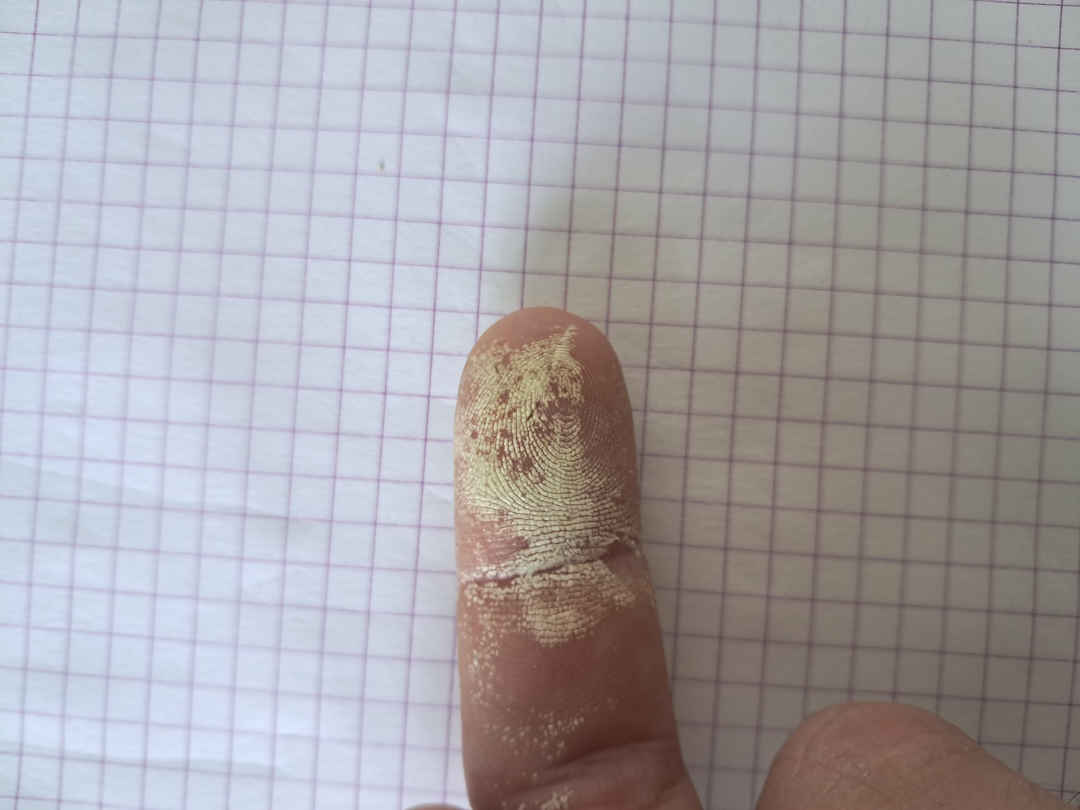 Hydrogen peroxide on the skin