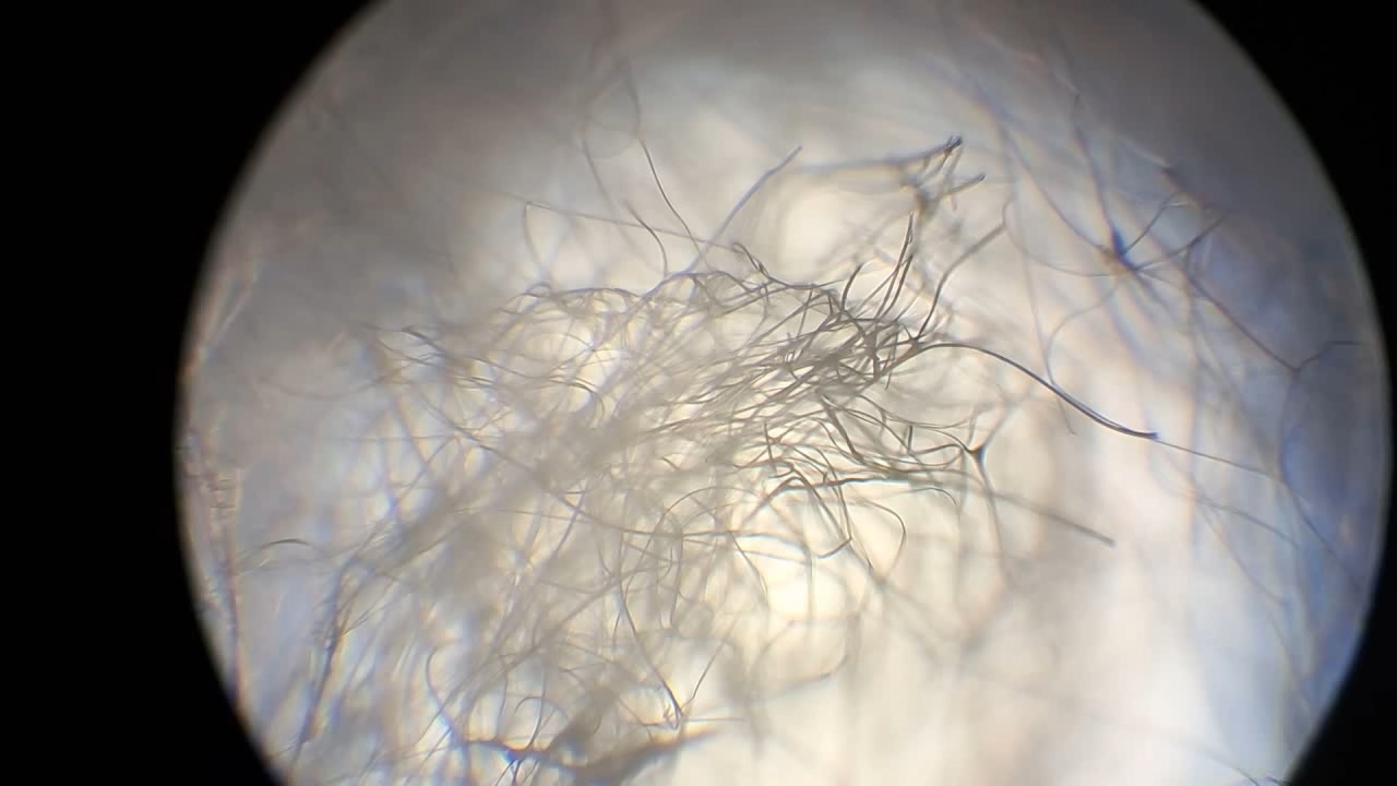 Electrospinning: Solution of Polymethyl Methacrylate (PMMA) in Methylene Chloride