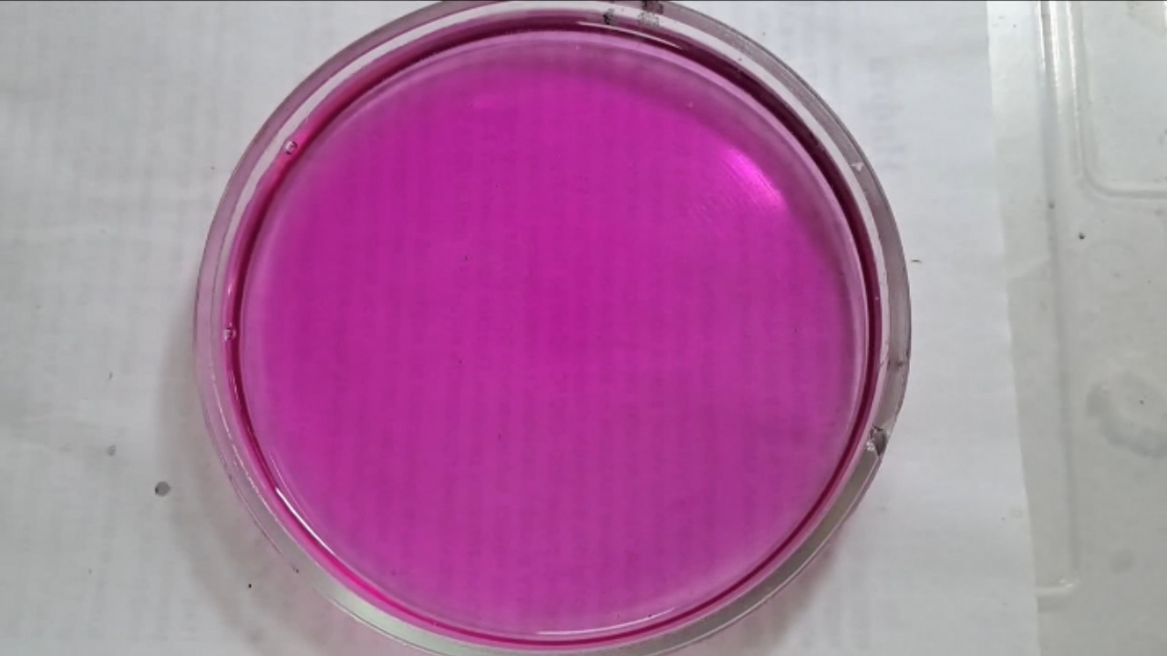 Phenolphthalein Turns Fuchsia When Acid Is Added