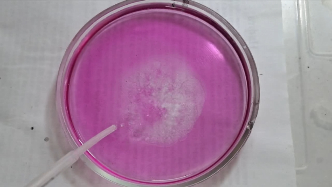 Phenolphthalein Turns Fuchsia When Acid Is Added