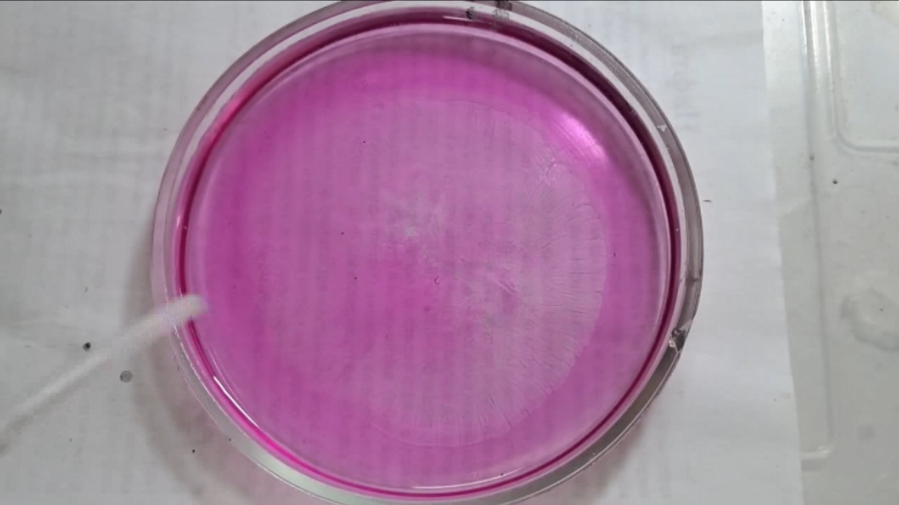 Phenolphthalein Turns Fuchsia When Acid Is Added