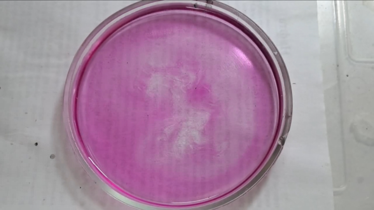 Phenolphthalein Turns Fuchsia When Acid Is Added