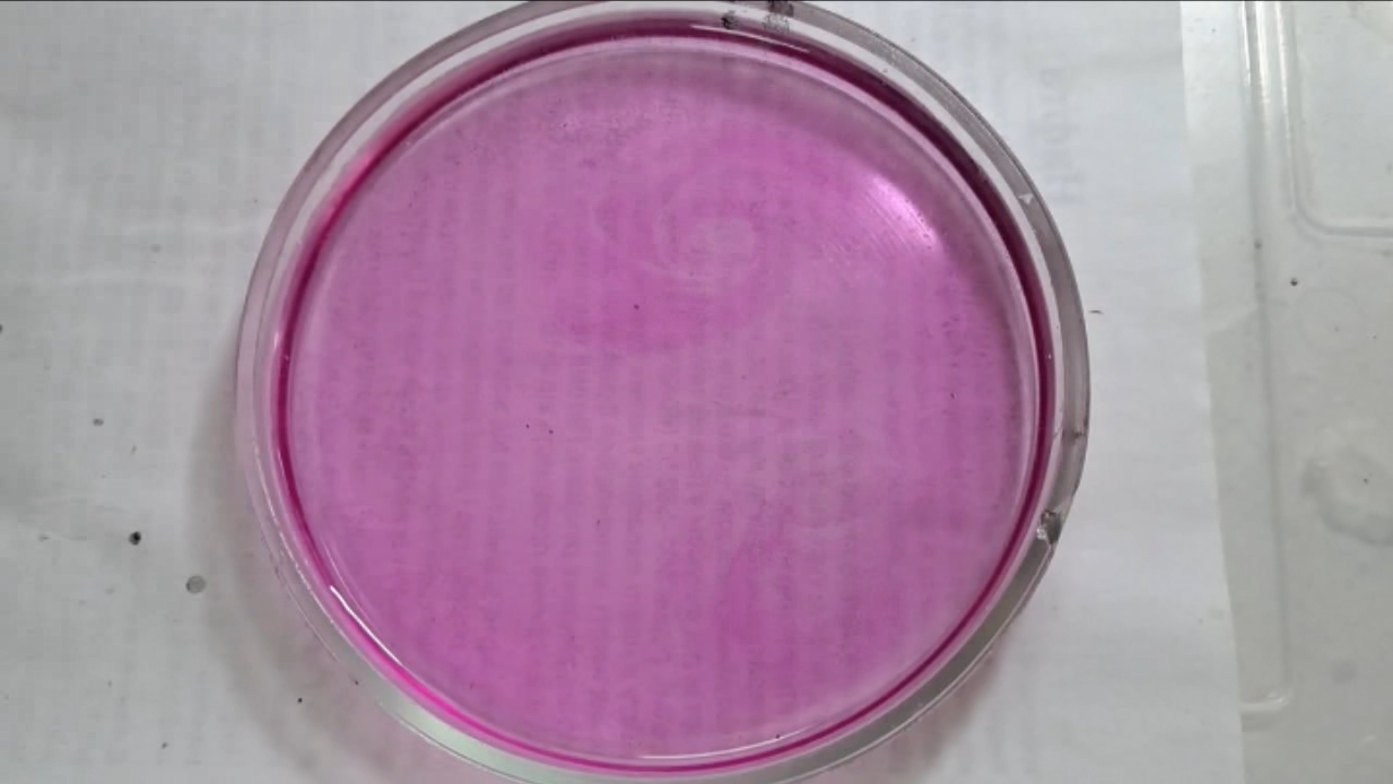 Phenolphthalein Turns Fuchsia When Acid Is Added