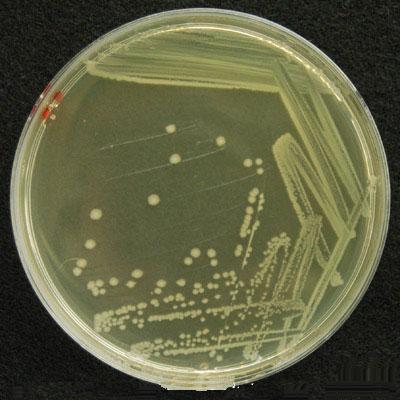  Escherichia coli  