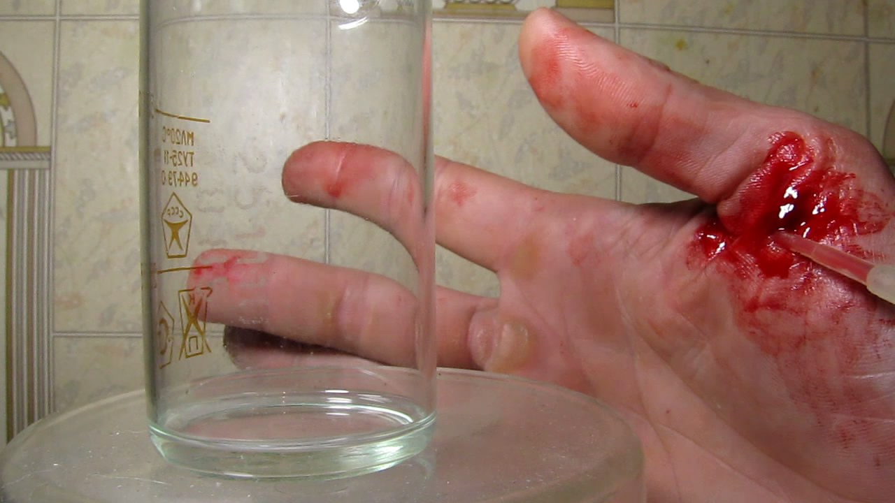    . Hydrogen peroxide and blood