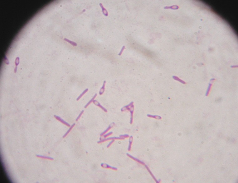 Clostridium botulinum. ,      - 