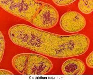 Clostridium botulinum. ,      - 