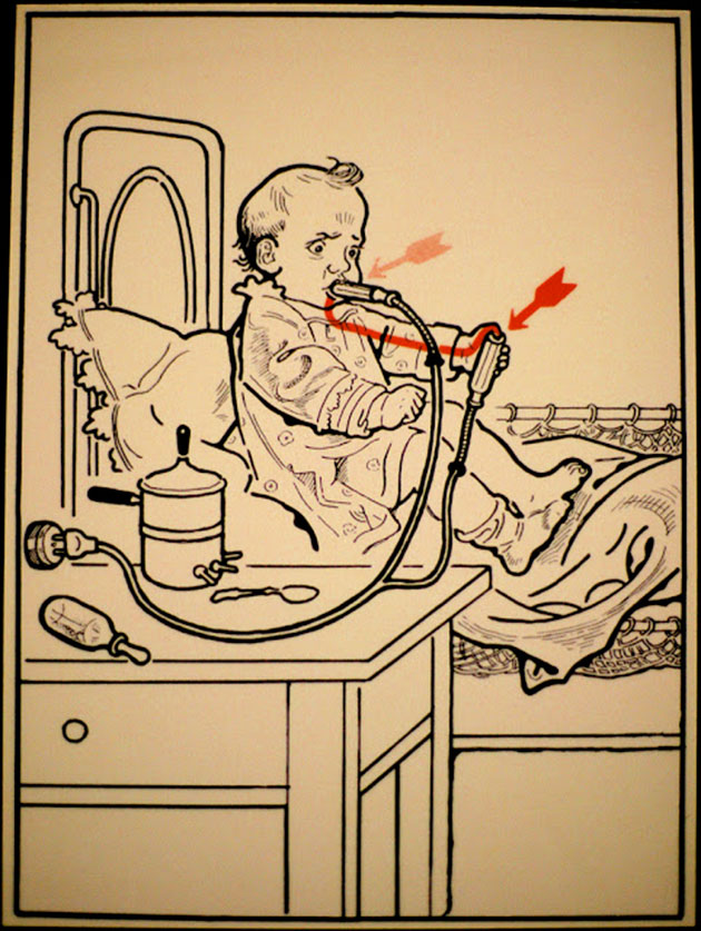   1931 ,  ,        . These diagrams from 1931 illustrate some ways to die of electrocution