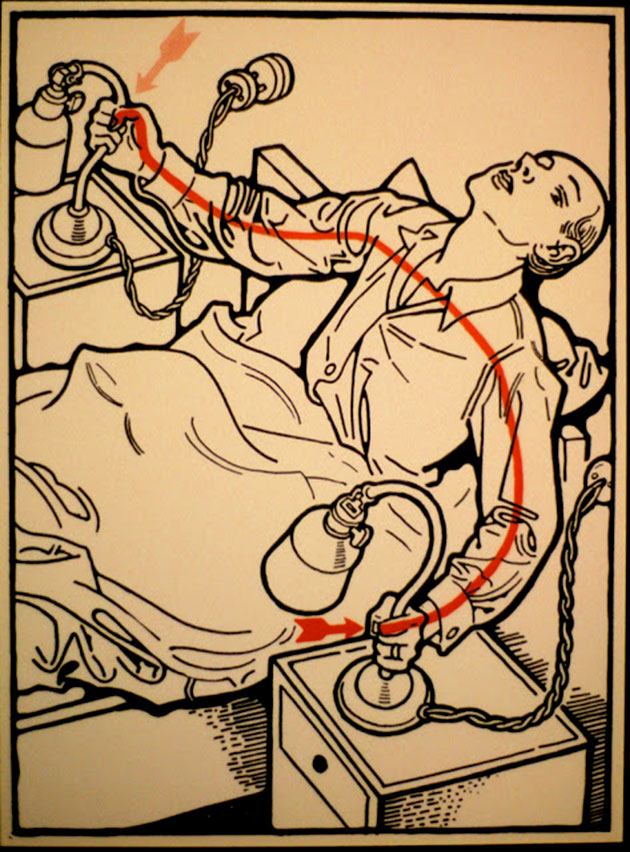   1931 ,  ,        . These diagrams from 1931 illustrate some ways to die of electrocution