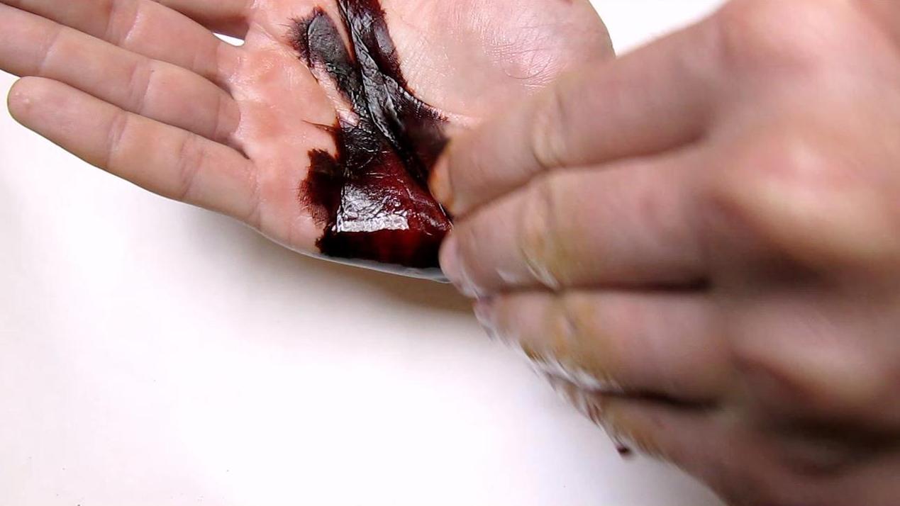 Как и чем лечить глубокий порез на руке? | Пикабу