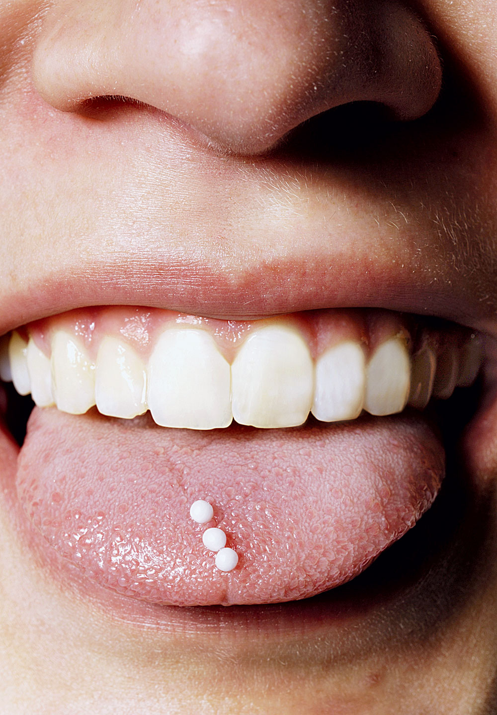 . Homeopathy