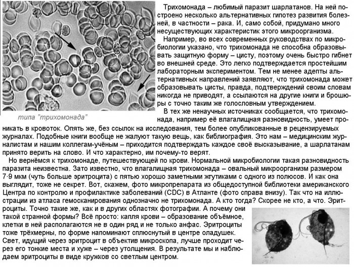 ''Гемосканирование''_03_типа_''Трихомонада''.jpg