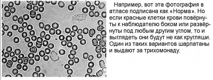 ''Гемосканирование''_05_Норма.jpg