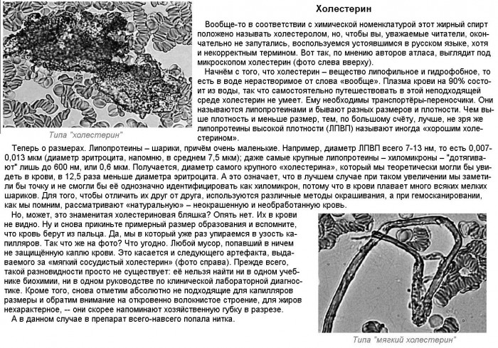 ''Гемосканирование''_10_типа_''холестерин''.jpg